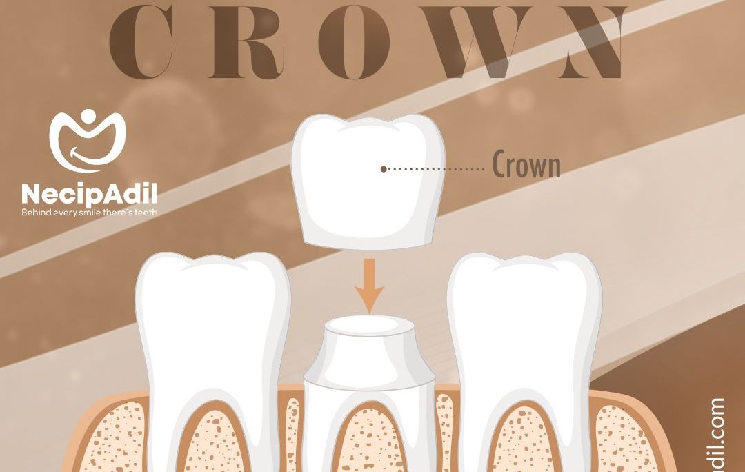 Dental Crown