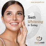 Teeth Whitening in Turkey