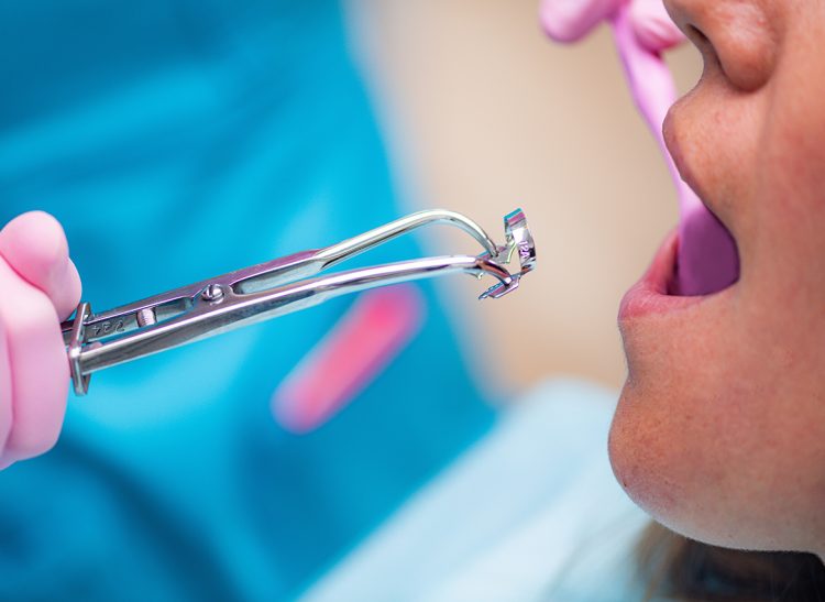 Endodontics – Endodontist Preparing Instruments for Root Canal Treatment in Dental Clinic.