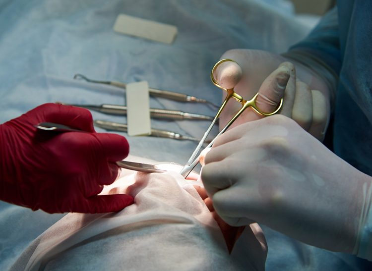 Surgery in the dental clinic.Doctor sews up a wound in the patient's mouth after the operation in the dental clinic.