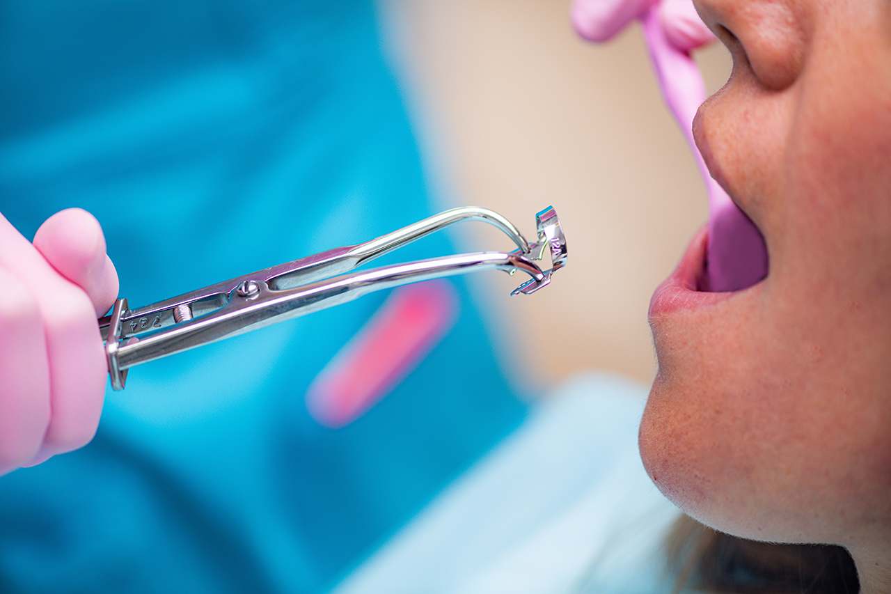 Endodontics – Endodontist Preparing Instruments for Root Canal Treatment in Dental Clinic.