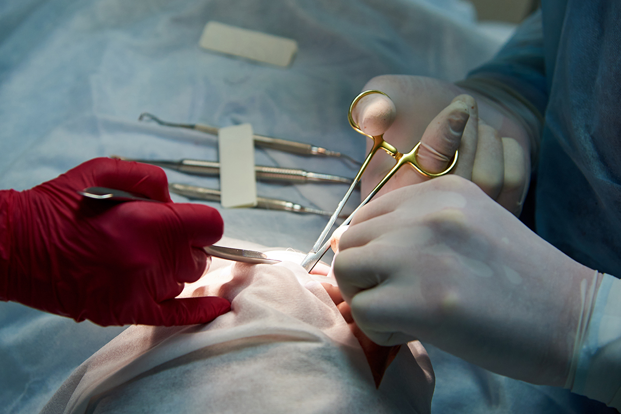 Surgery in the dental clinic.Doctor sews up a wound in the patient's mouth after the operation in the dental clinic.